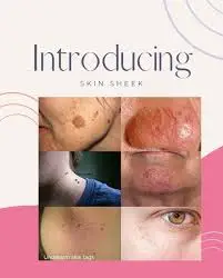 Skin Imperfection Treatment