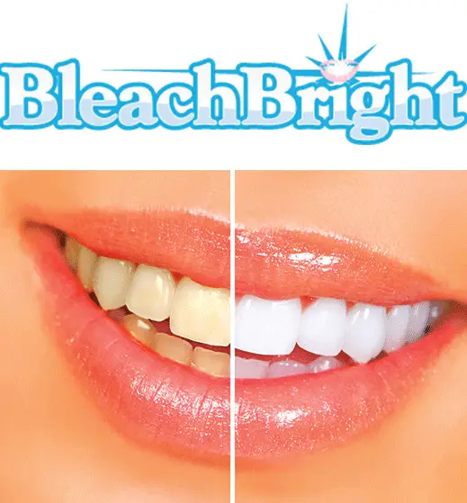 Teeth Whitening