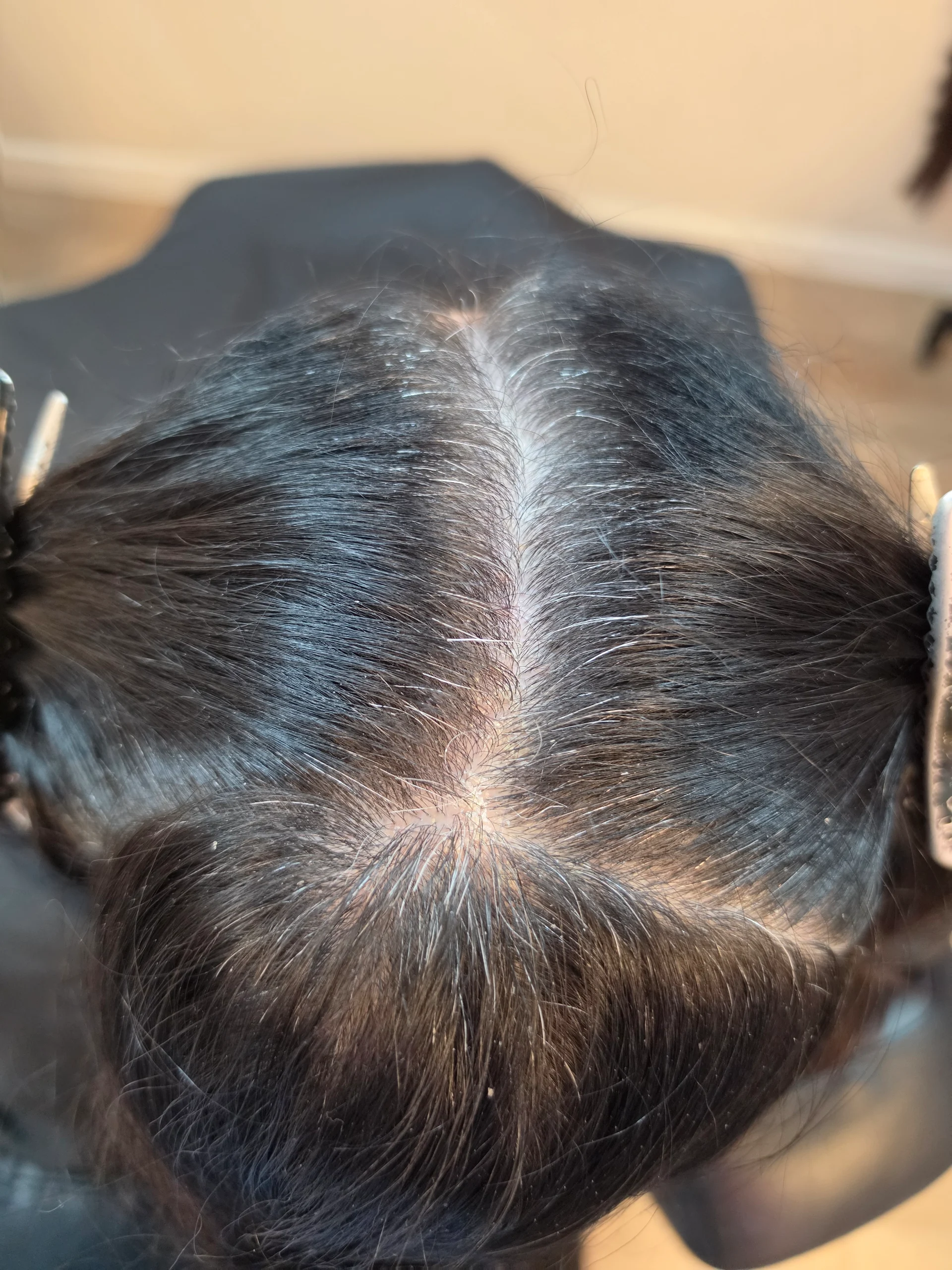 Root retouch