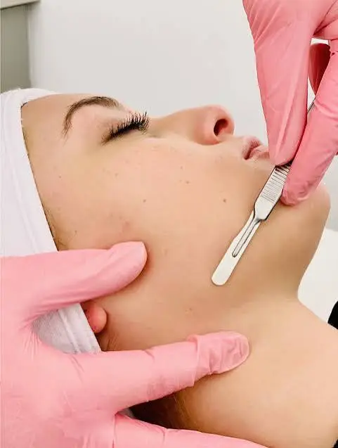 Dermaplaning Add On