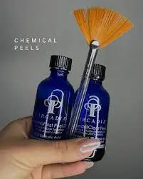 Chemical Peel - Consult Required for your first peel with me