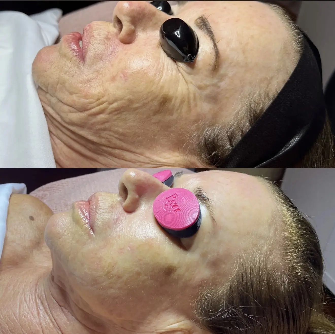The SWITCH Rejuvenation 6 